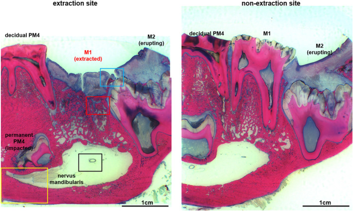 Fig 11