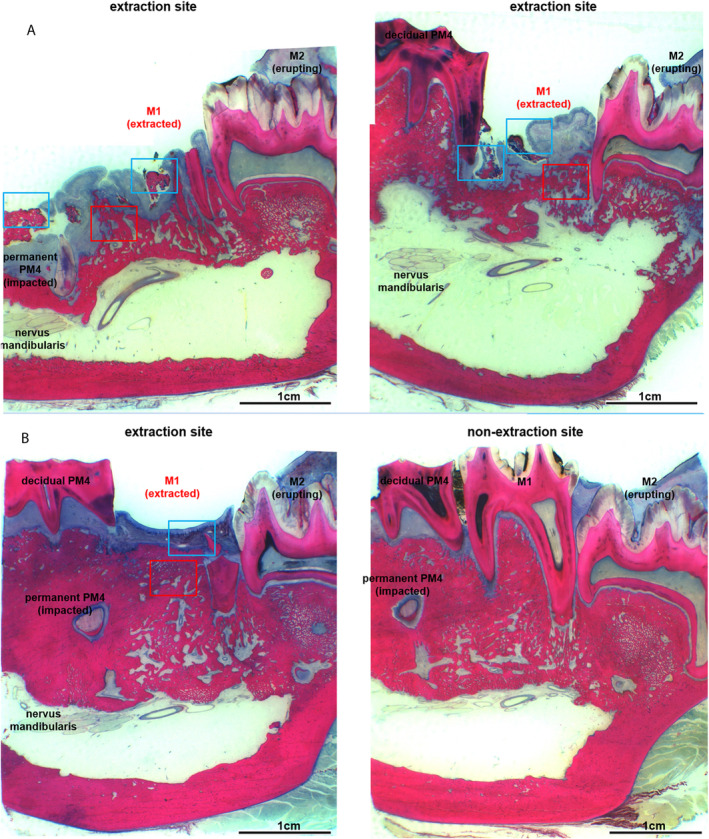 Fig 12