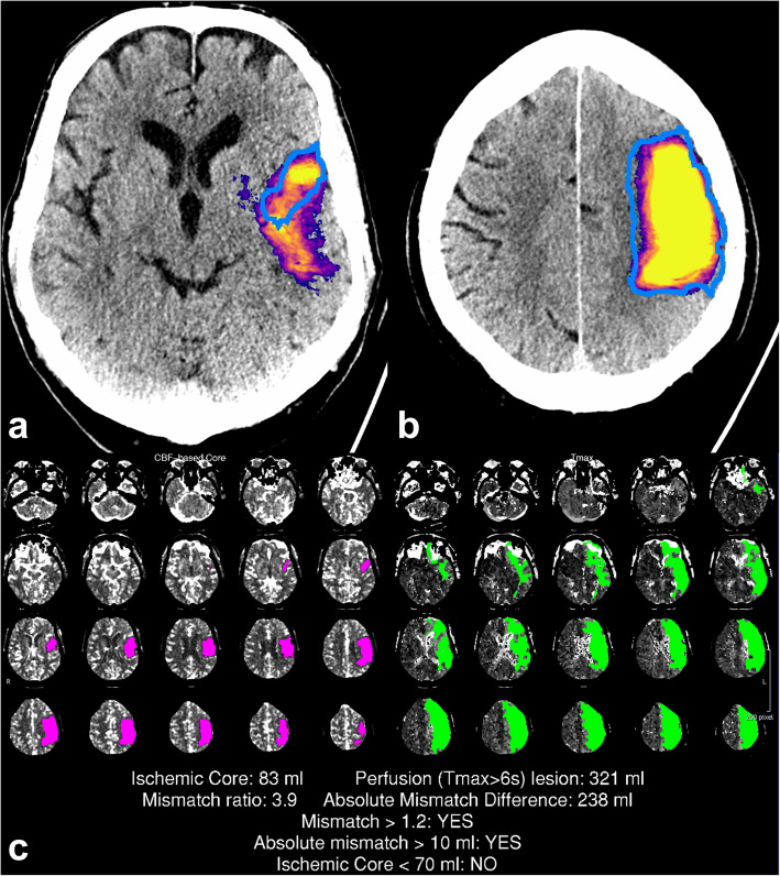 Fig. 2