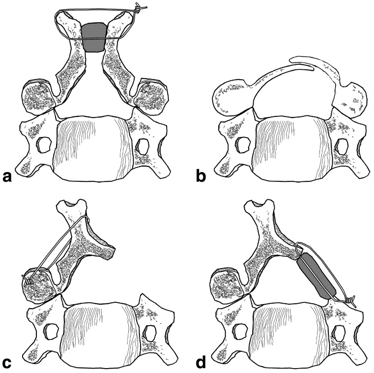 Fig. 1a–d.