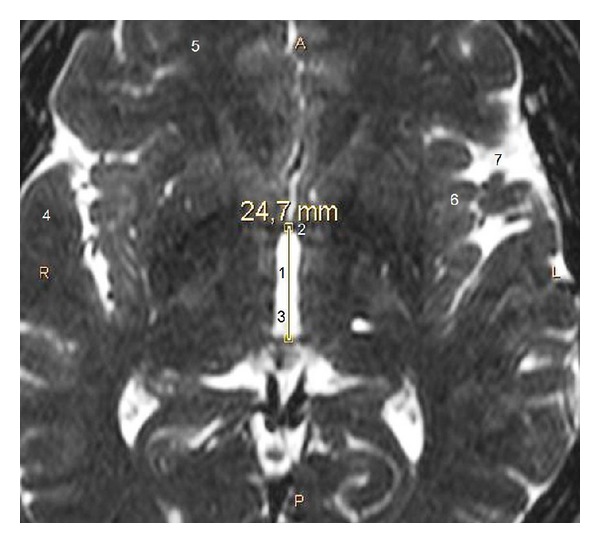 Figure 2