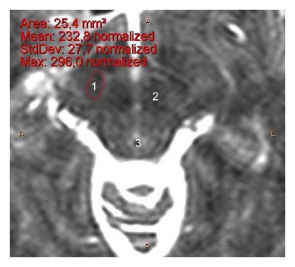 Figure 1