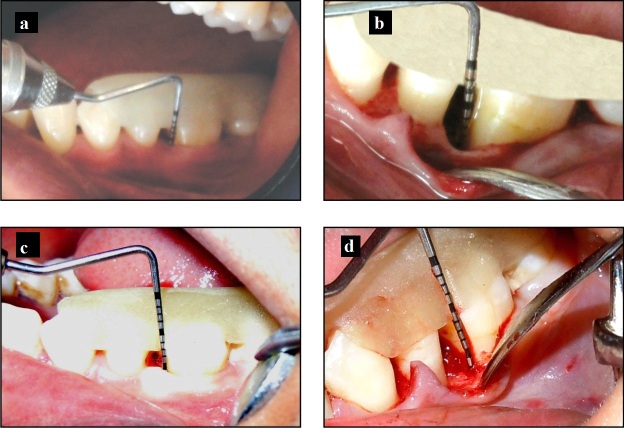 [Table/Fig-3]: