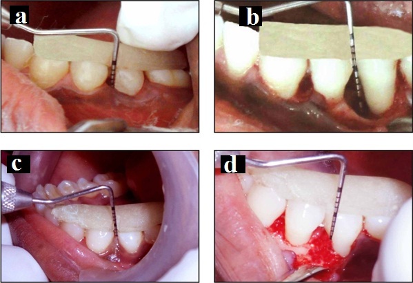 [Table/Fig-4]: