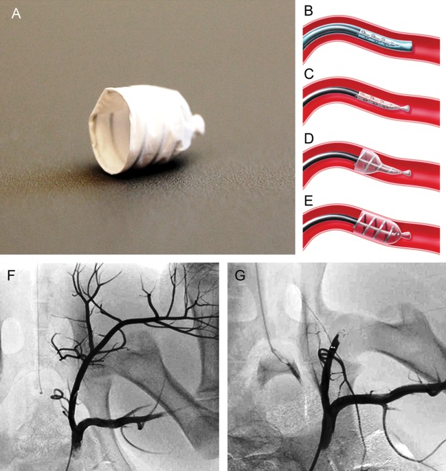 Figure 1: