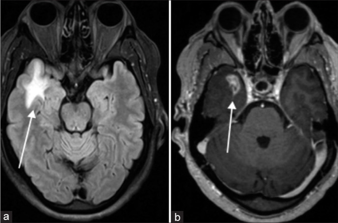 Figure 11: