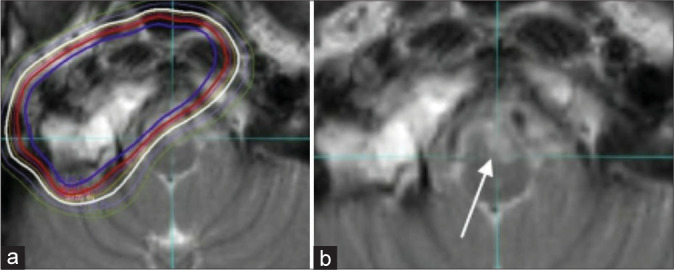 Figure 10: