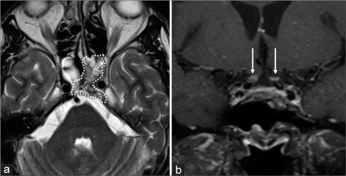 Figure 12: