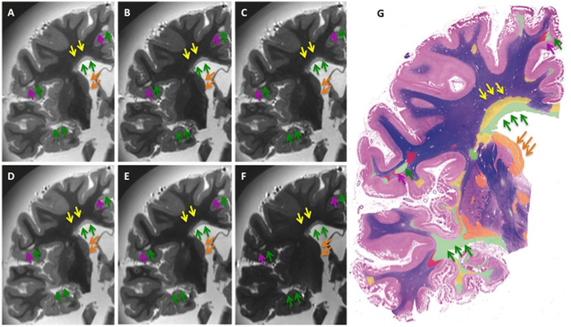 Fig 5.