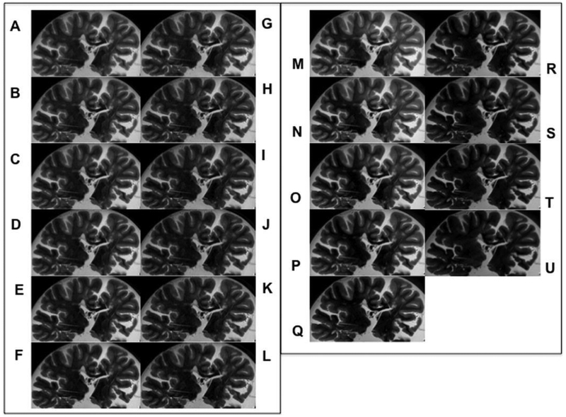 Fig 2.