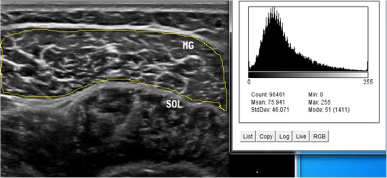 Fig. 3