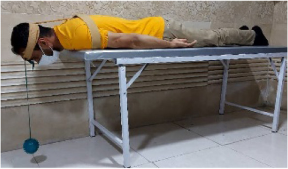 Fig. 2