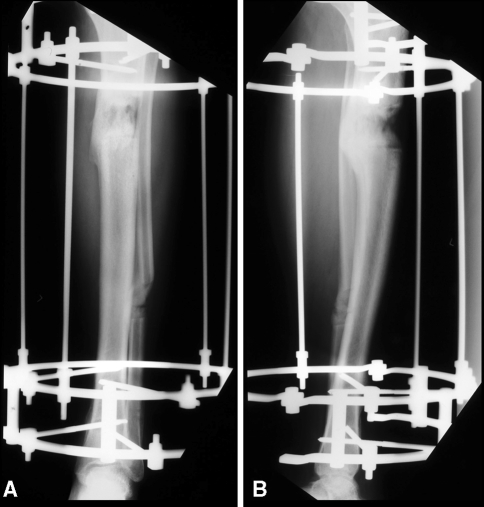 Fig. 3A–B