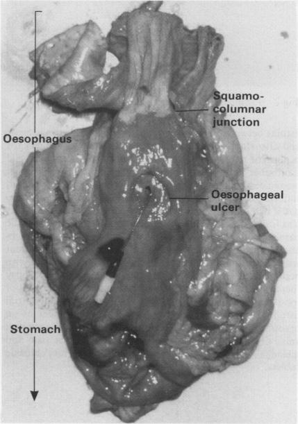 graphic file with name thorax00273-0069-a.jpg