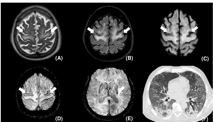 FIGURE 1: