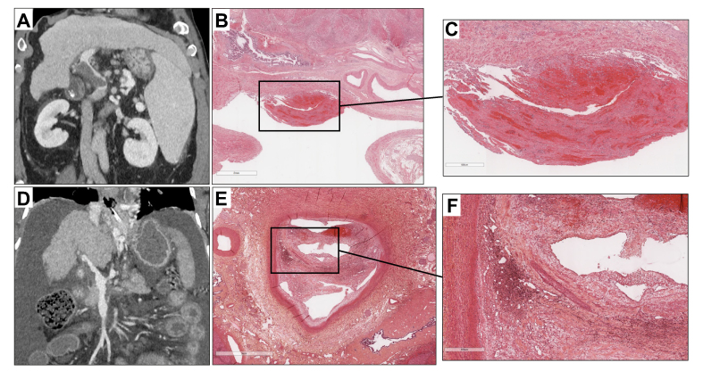 Fig. 4