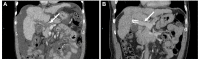 Fig. 5