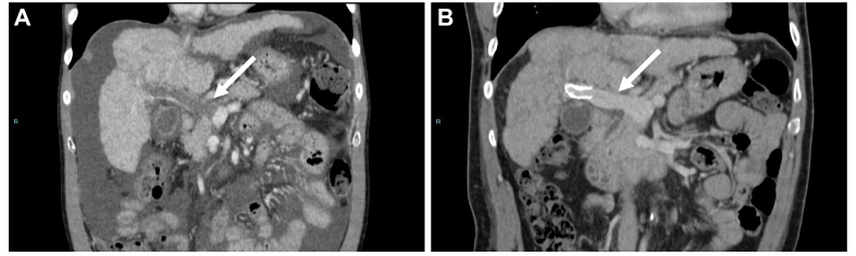 Fig. 5