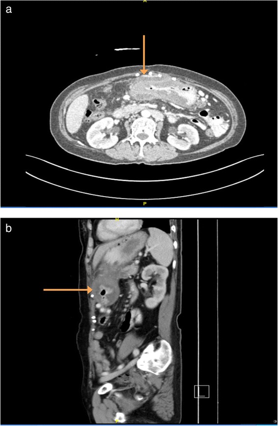 Fig. 1