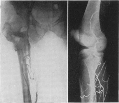 Fig. 9 (left)., Fig. 10 (right).