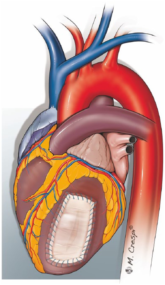 Figure 6.