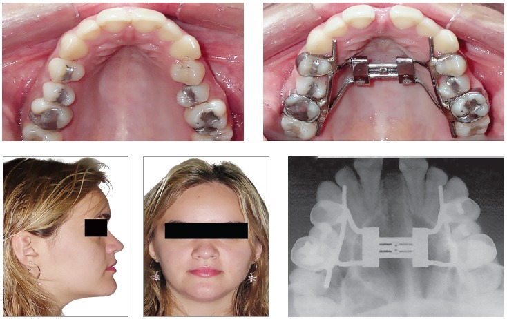 Figure 13