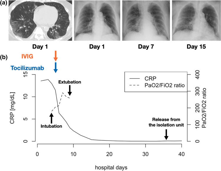 Fig. 2