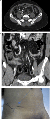 Fig. 1