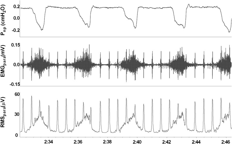 Figure 1