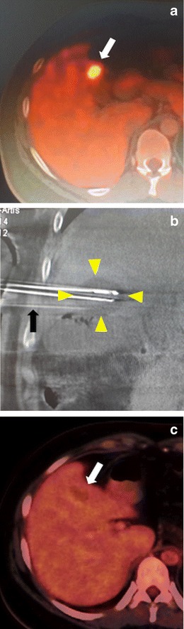 Fig. 9