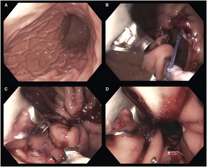 Figure 2.