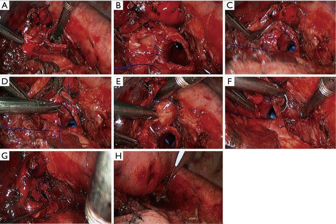 Figure 29