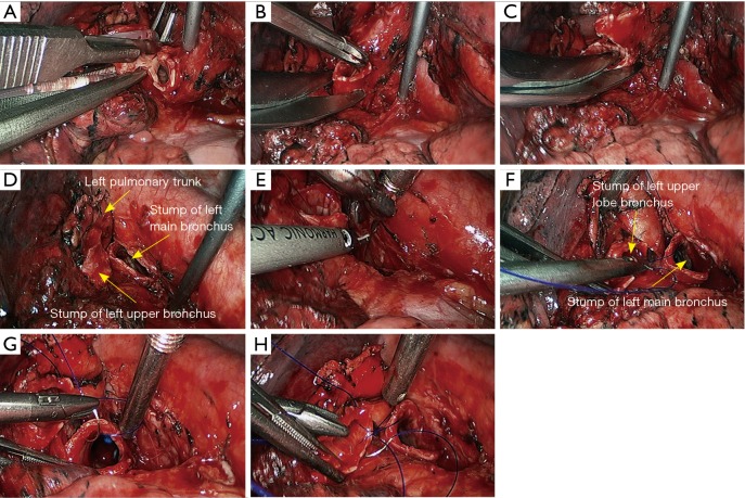 Figure 28