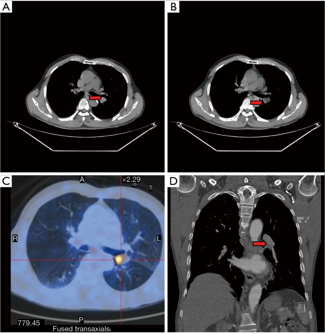 Figure 26