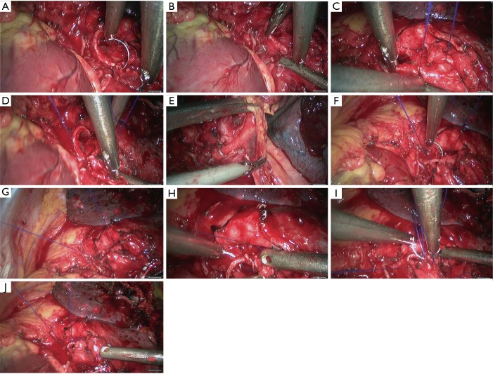 Figure 23