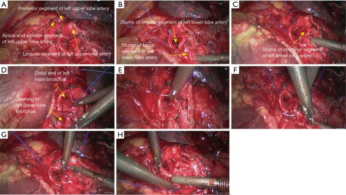 Figure 22