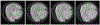 Fig. 16.