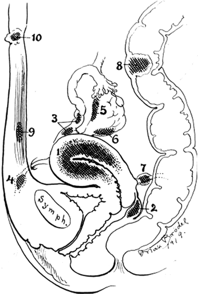 Fig. 1