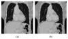 Fig. 11