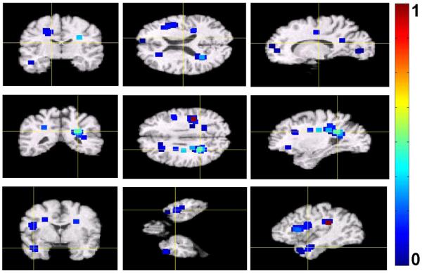 Figure 14