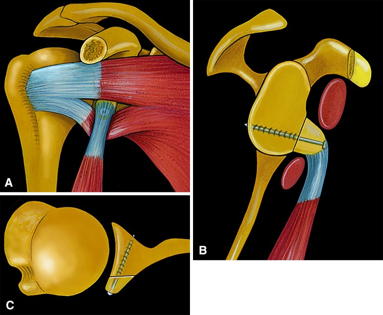 Fig. 2A–C