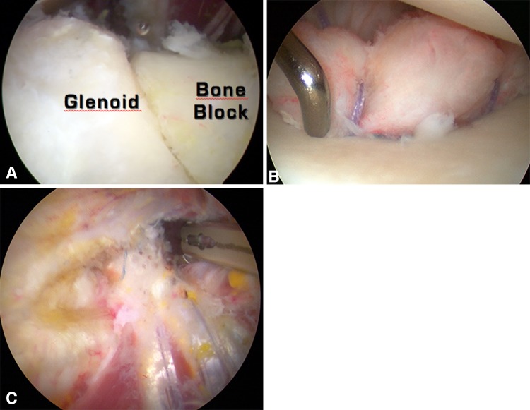 Fig. 4A–C