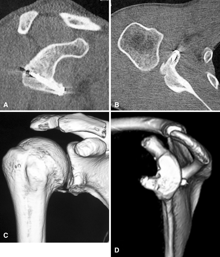 Fig. 6A–D