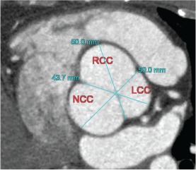 CLC-22359-FIG-0003-c