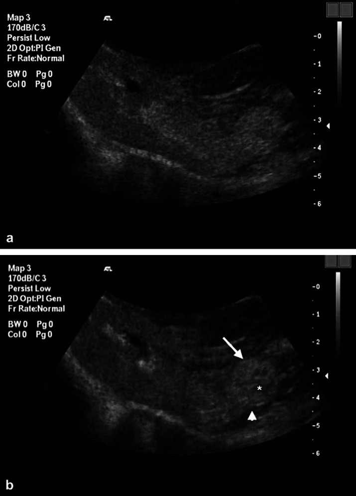 Fig 3.