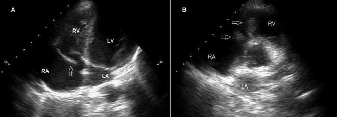 Figure 2