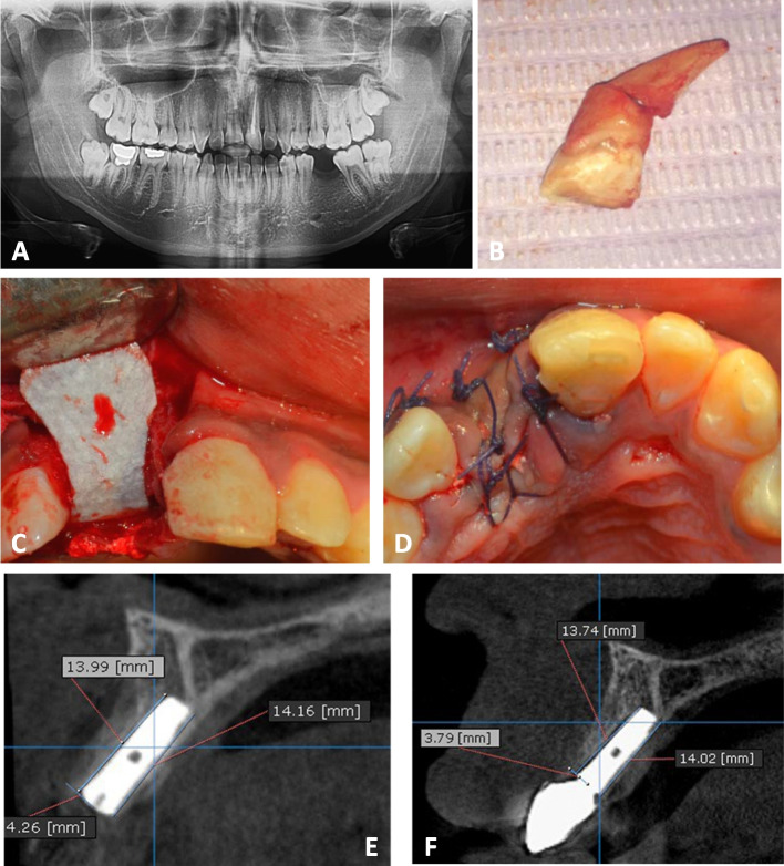Fig. 6