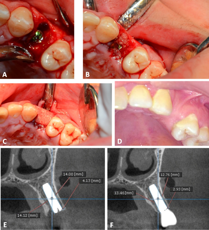 Fig. 4