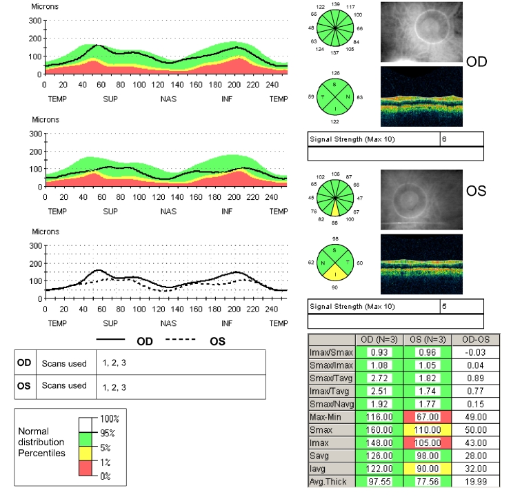 FIGURE 4