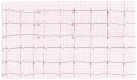 Fig. (4)
